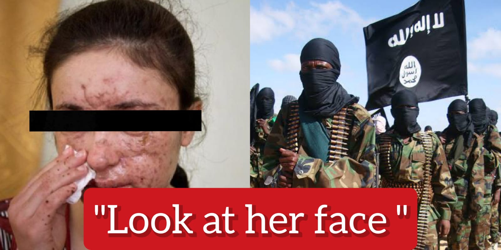 Meet the woman who was s*x slave in ISIS camps, that's how she looks after the agony