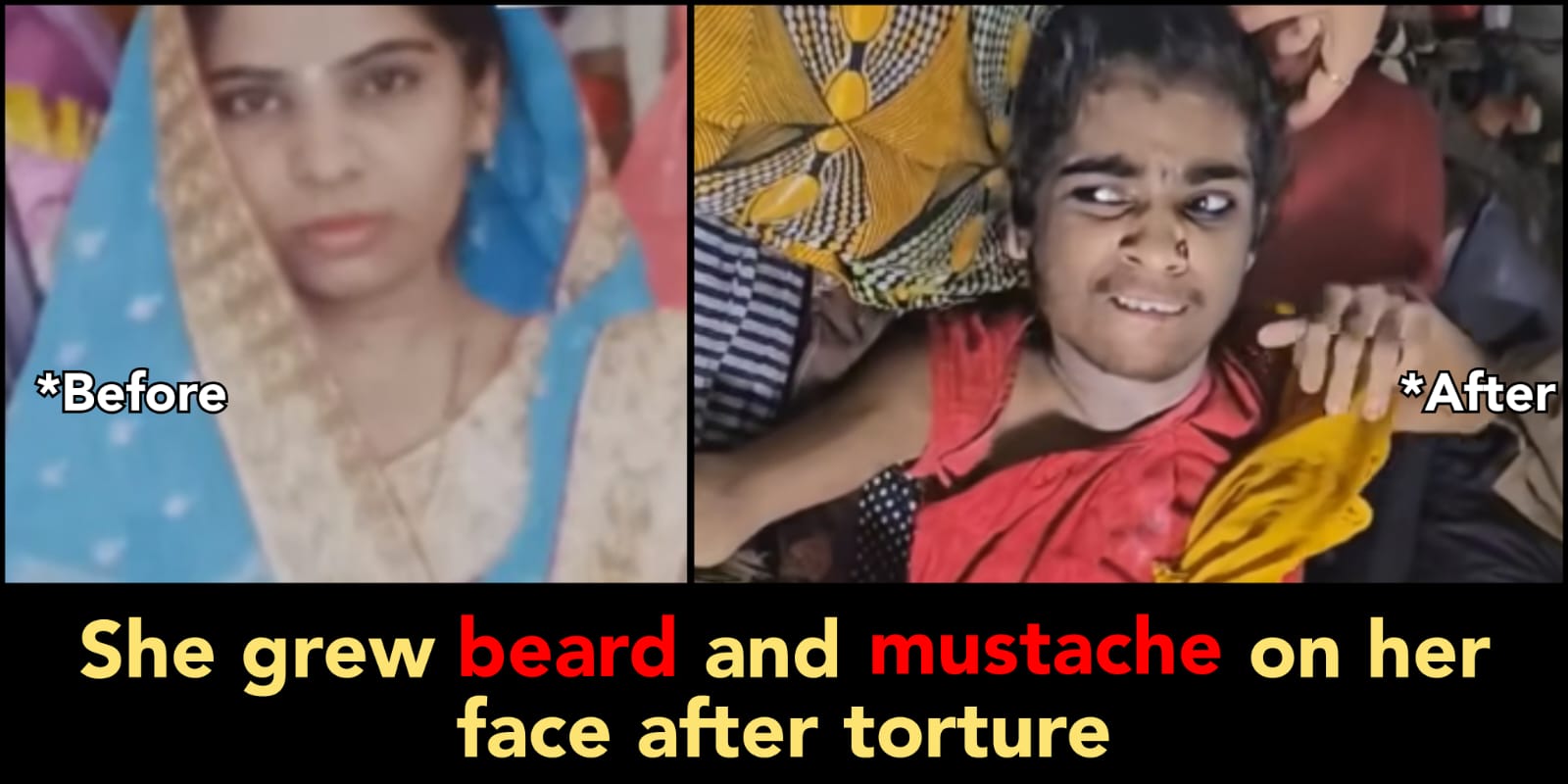 Husband tortures and beats wife for year, and gives injection to change her gender