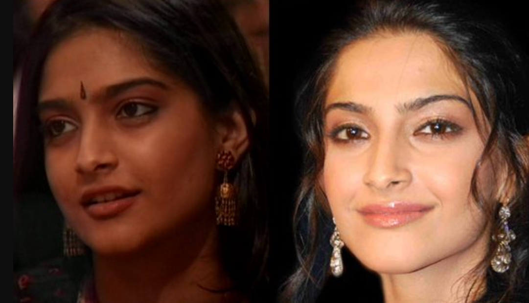 Sonam Kapoor's take on actress undergoing ‘Plastic Surgeries’ goes viral