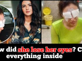 New update on Actress Jasmine Bhasin who lost eyes, she says…