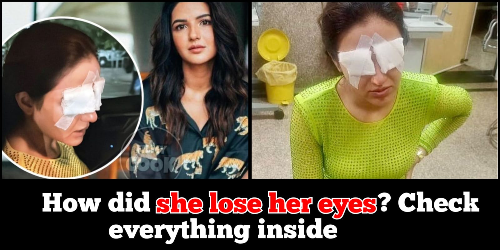 New update on Actress Jasmine Bhasin who lost eyes, she says…