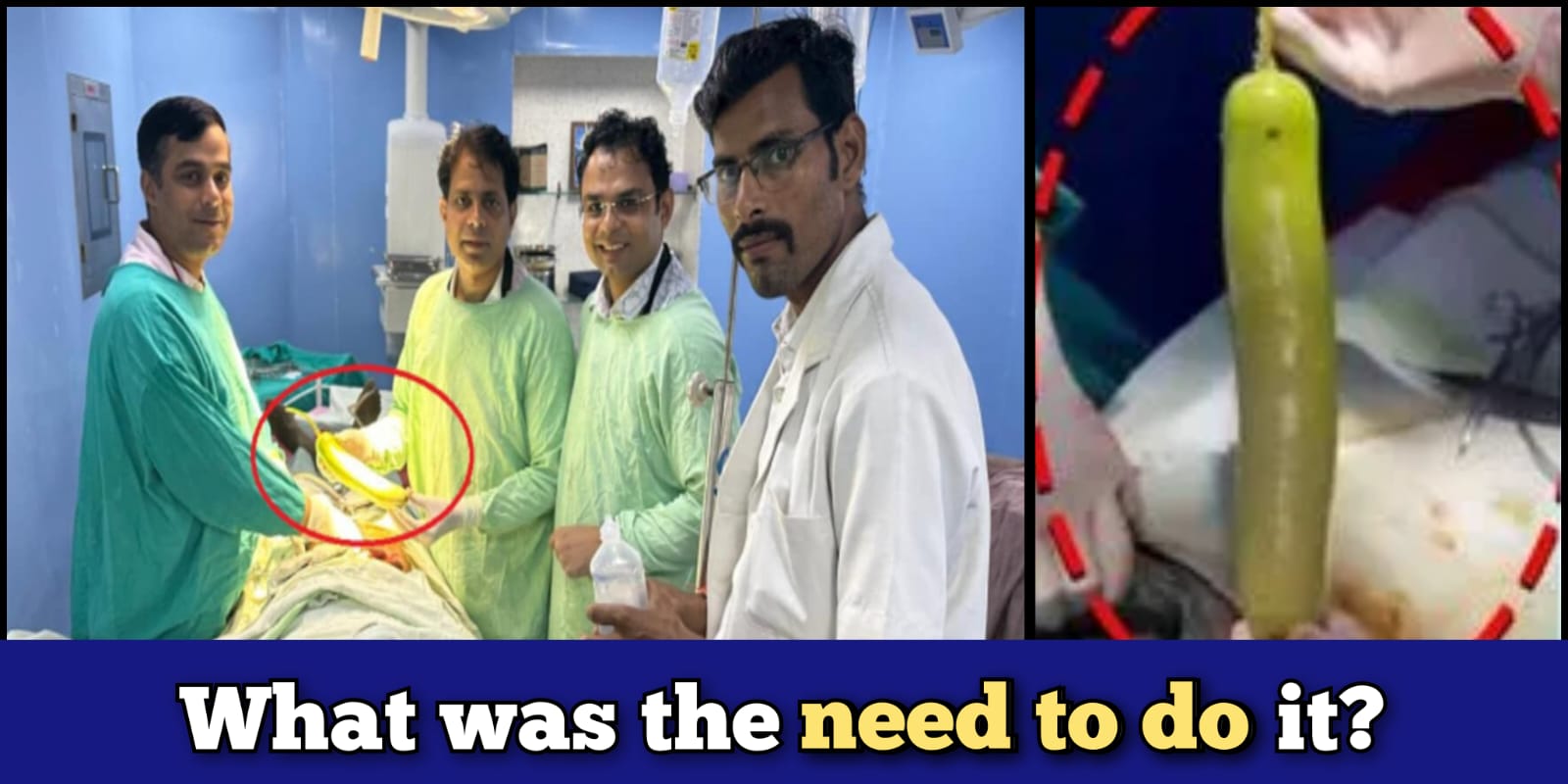 Madhya Pradesh, India: bottle gourd stuck in Private part, doctors remove it through surgery