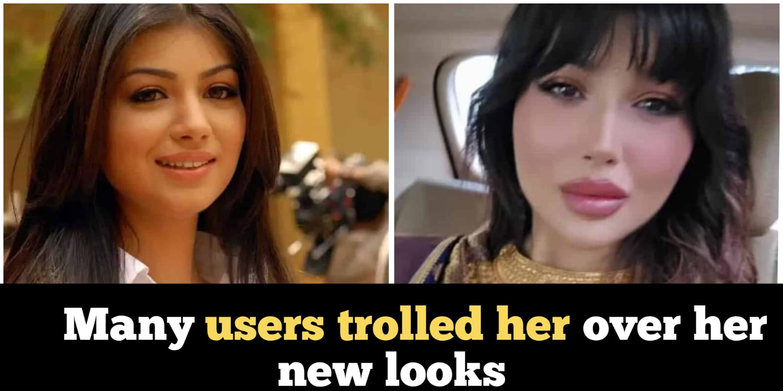 Ayesha Takia deletes her Instagram account after her surgery goes wrong, check details